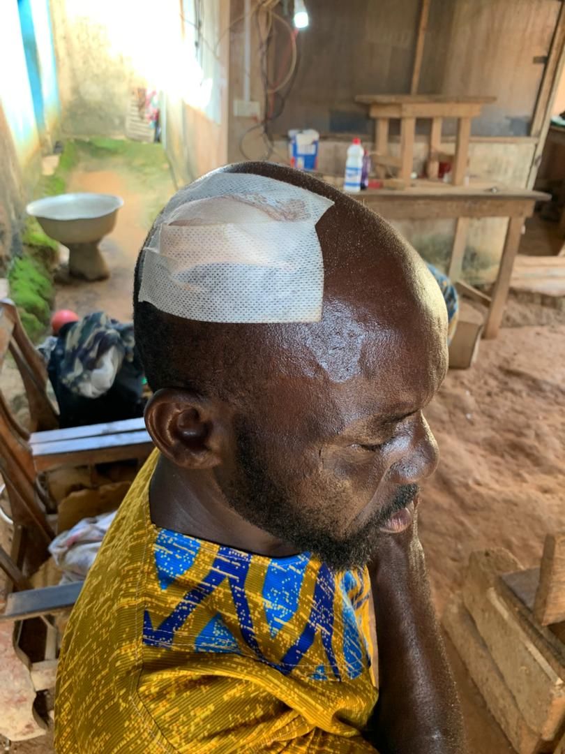 WR: 2 persons in critical condition after violent chieftaincy clash at Wassa Domama